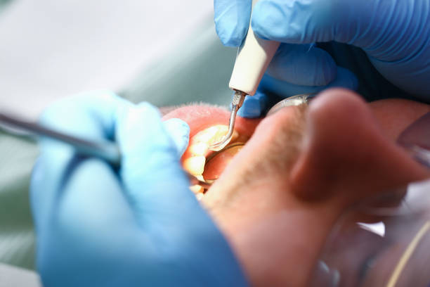 Best Broken Tooth Emergency  in Manorhaven, NY